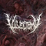Vulvectomy