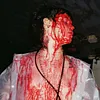 SARCOMA
